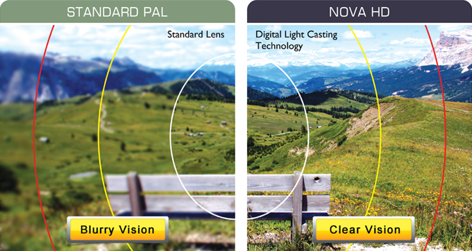 stander_lens stander_lens